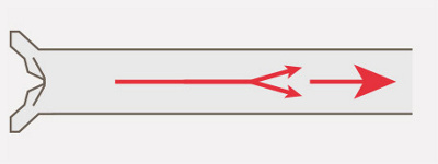 hirslanden-der-mensch-ist-so-jung-wie-seine-gefaesse-2