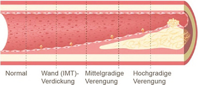 hirslanden-der-mensch-ist-so-jung-wie-seine-gefaesse-3