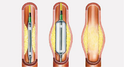 hirslanden-der-mensch-ist-so-jung-wie-seine-gefaesse-4