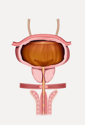 hirslanden-die-blase-nicht-mehr-kontrollieren-koennen-3