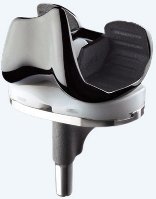 hirslanden-die-knieprothese-1