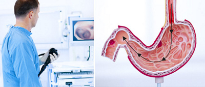 hirslanden-endosonografische-untersuchungen-und-eingriffe-bei-erkrankungen-des-magendarmtraktes-1
