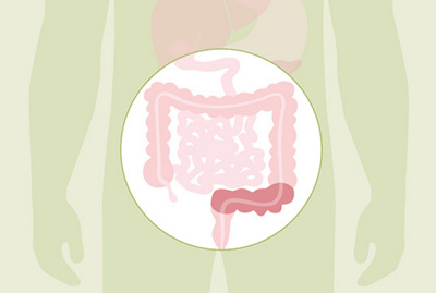 Grafik Überblick des Darms