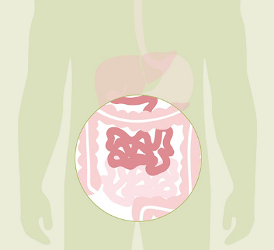 hirslanden-faszination-darm-hotspot-Leerdarm