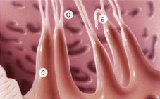 hirslanden-herausforderungen-der-modernen-mitralklappenrekonstruktion-2