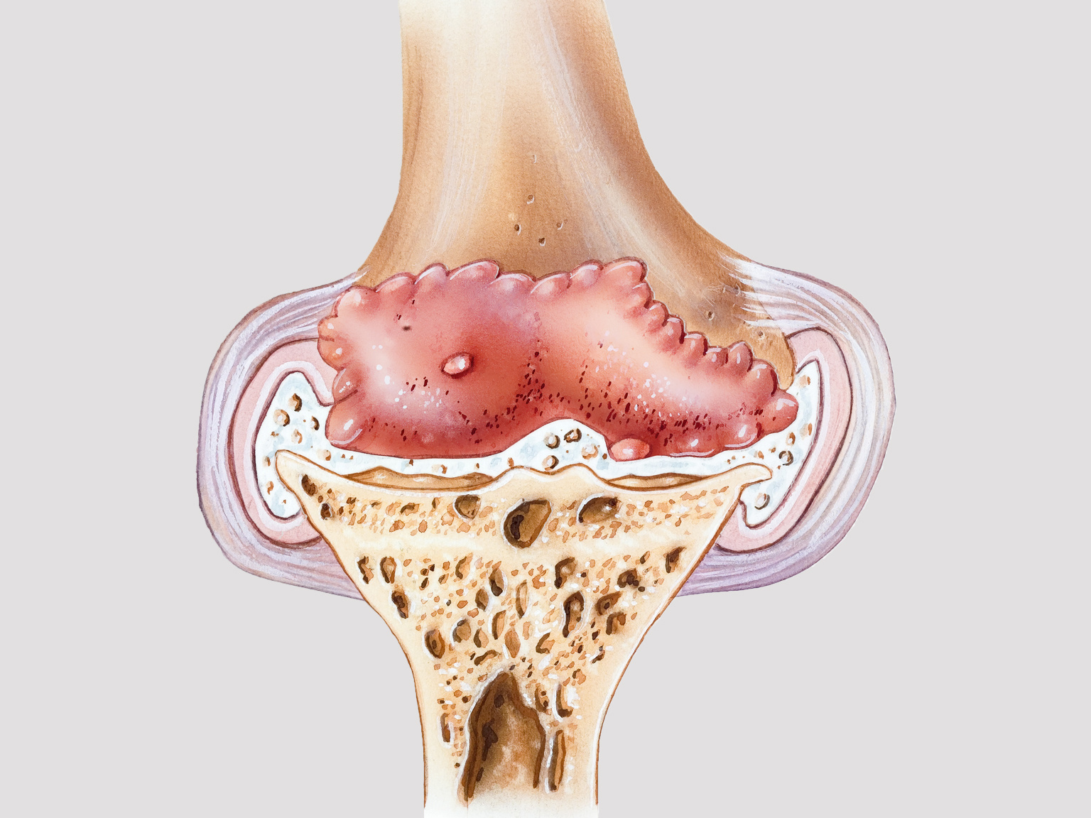 Avant-bras : anatomie, rôle, pathologies, traitements