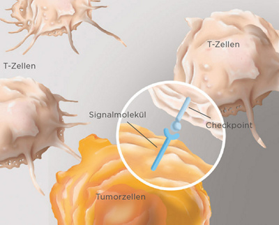 hirslanden-immuntherapien-gegen-krebs-1