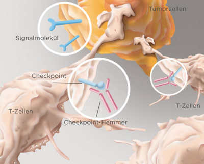 hirslanden-immuntherapien-gegen-krebs-2
