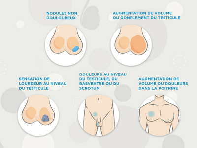 Douleur aux testicules : comment reconnaître un testicule malade