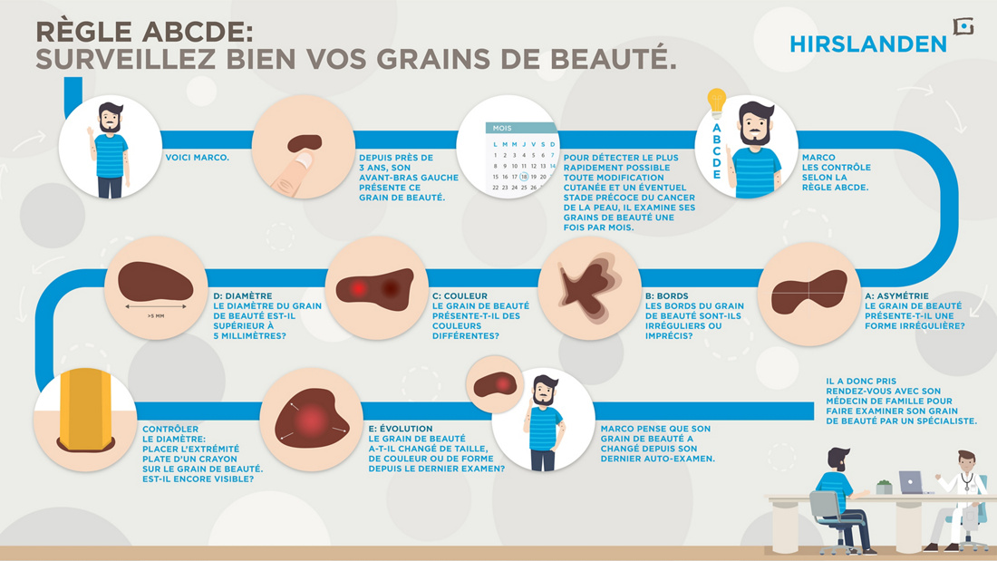 Regle Abcde Surveillez Bien Vos Grains De Beaute Hirslanden