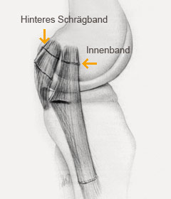 hirslanden-innenbandriss-des-kniegelenkes-3