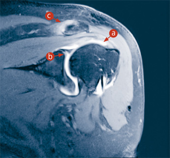 hirslanden-interventionelle-radiologie-1