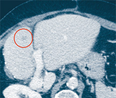 hirslanden-interventionelle-radiologie-2