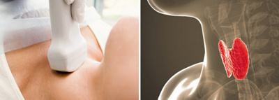 hirslanden-knoten-im-halsbereich-1