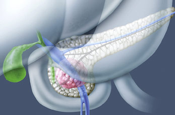 hirslanden-leber-und-pankreaskrebs-3