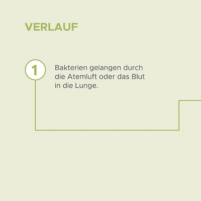 Verlauf einer Lungenentündung in 4 Schritten