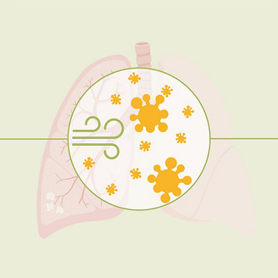 hirslanden-lungennotfall-lungenentzündung-infografik-06