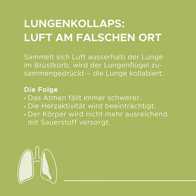 Infografik Lungenkollaps 1