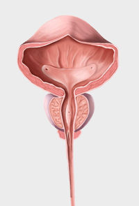 hirslanden-minimalinvasiver-gefaessverschluss-prostata-schrumpfen-1