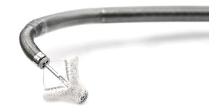 hirslanden-mitralinsuffizienz-2