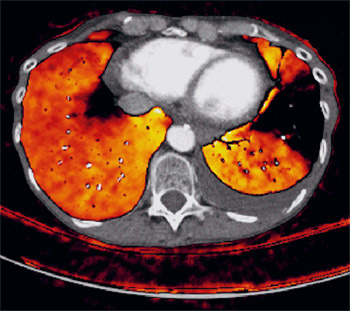 hirslanden-moderne-bildgebung-1