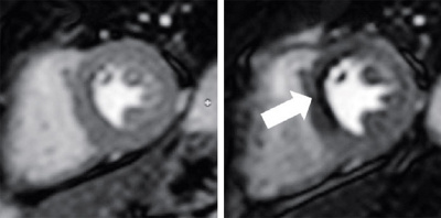 hirslanden-moderne-methodenzur-abklaerung-von-brustschmerzen-2
