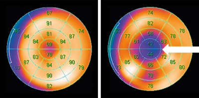 hirslanden-moderne-methodenzur-abklaerung-von-brustschmerzen-3