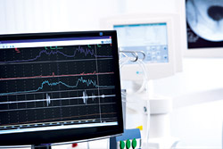 hirslanden-multiple-sklerose-1