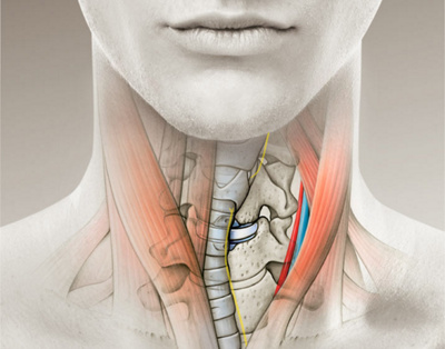 hirslanden-nackenschmerzen-1