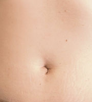 hirslanden-narbenfrei-operieren-2