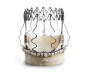 hirslanden-neue-chirurgische-verfahren-zum-ersatz-der-aortenklappe-2