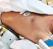 hirslanden-nierensteine-eine-gemeinsame-herausforderung-fuer-urologie-und-nephrologie-2