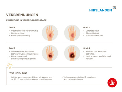 Einstufung in Verbrennungsgrade