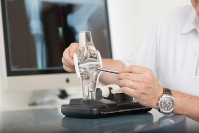 Knieprothese - Arzt kontrolliert die Knieprothese