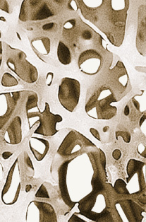 hirslanden-osteoporose-2