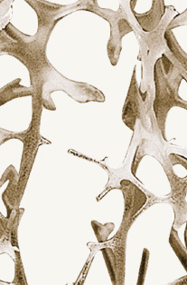 hirslanden-osteoporose-3