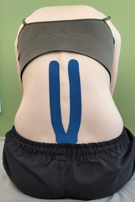 hirslanden-richtig-tapen-rueckentape-4