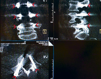 hirslanden-rueckenschmerzen-3