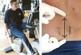 hirslanden-rueckenschmerzen-im-visier-1