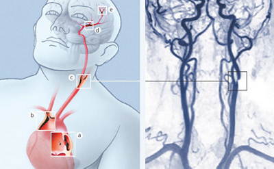 hirslanden-streifung-vorbote-einer-vermeidbaren-katastrophe-2