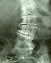 hirslanden-was-ist-eigentlich-rheuma-4