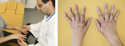 hirslanden-was-ist-eigentlich-rheuma-5