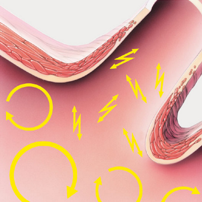 hirslanden-wenn-das-herz-aus-dem-takt-faellt-2