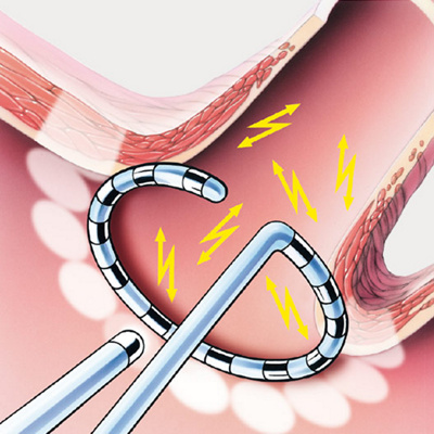 hirslanden-wenn-das-herz-aus-dem-takt-faellt-3