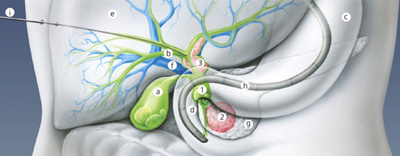 hirslanden-wenn-die-galle-staut-1