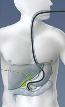 hirslanden-wenn-die-galle-staut-2