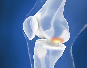 hirslanden-wenns-nach-jahren-wieder-schmerzt-1