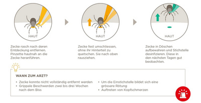 Zeckenbiss entfernen - was ist zu tun?