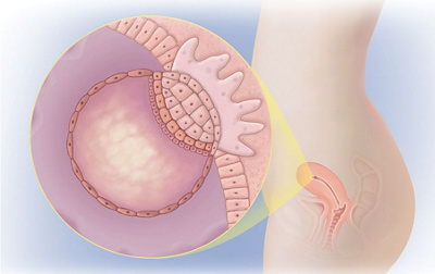 Schwangerschaftswoche 3