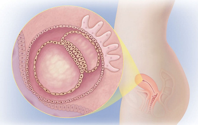 Schwangerschaftswoche 4